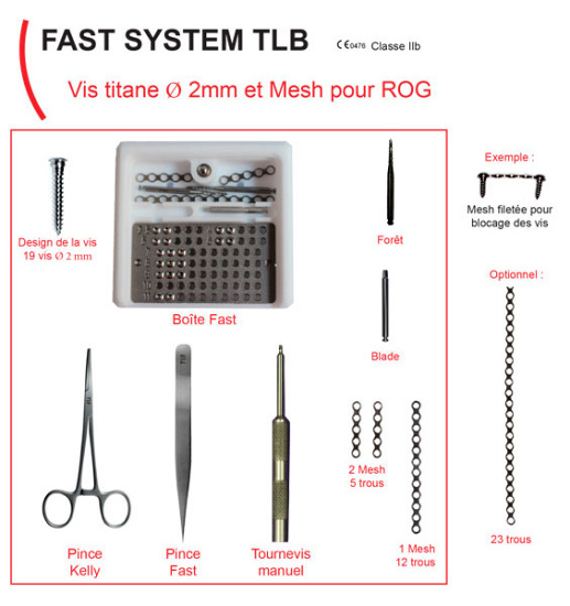 Fast system